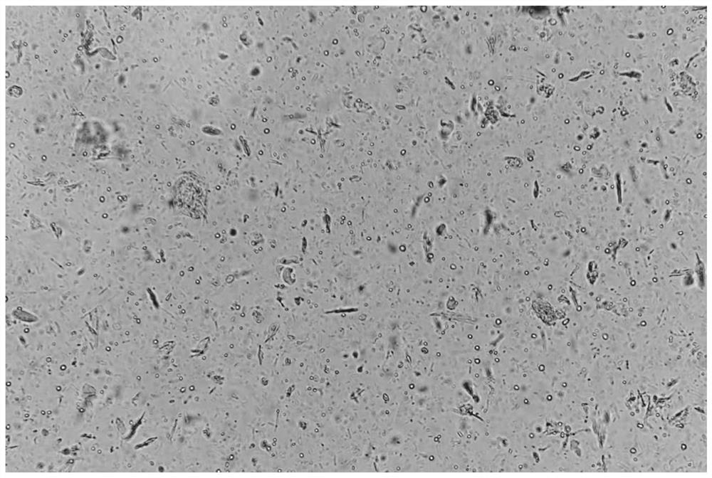 Preparation method and application of blastocystis hominis stained specimen