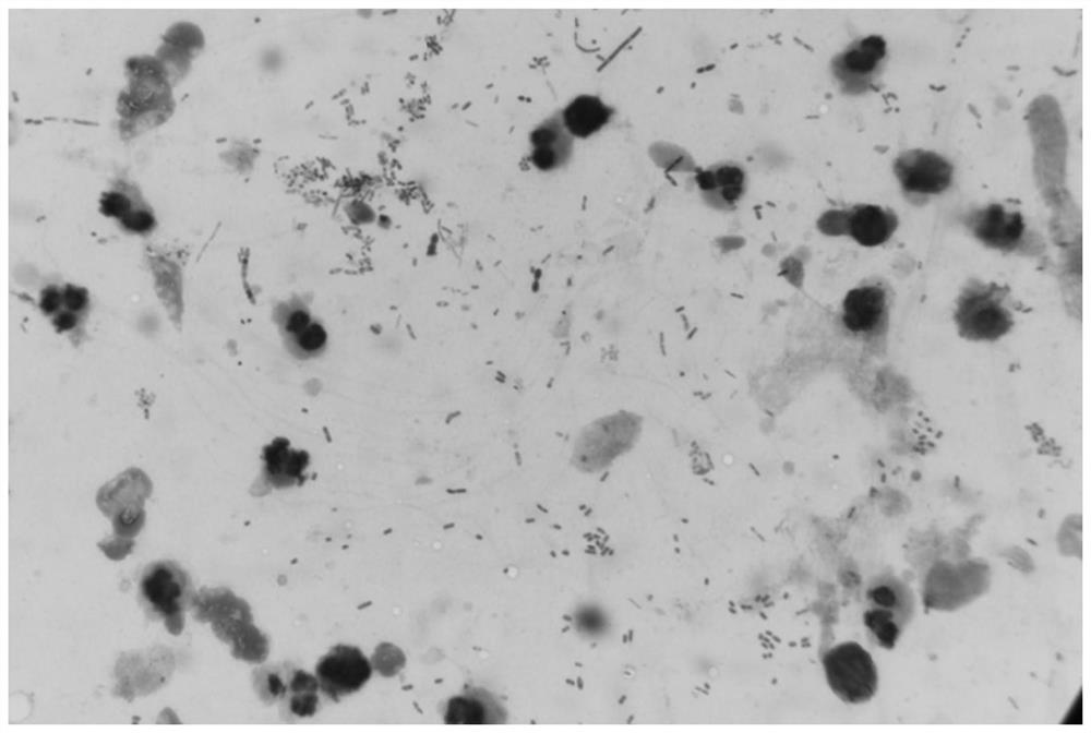 Preparation method and application of blastocystis hominis stained specimen