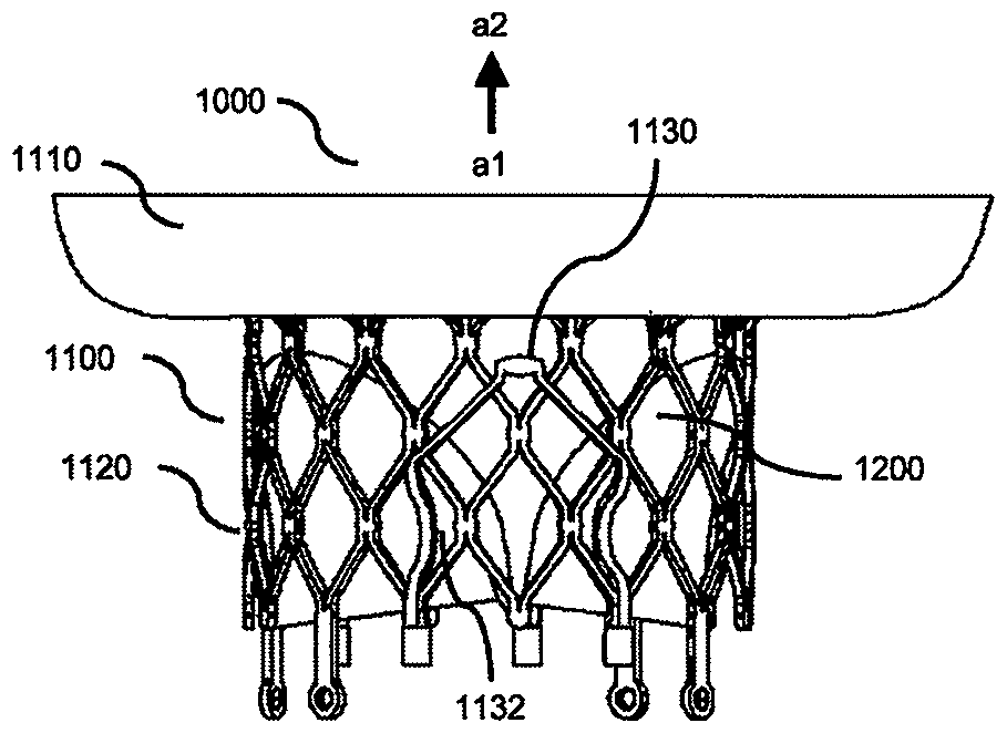 A heart valve prosthesis with clamping device