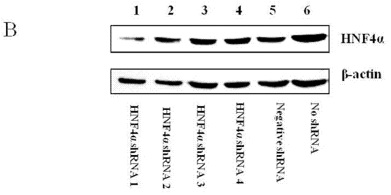 RNA interference sequence aiming at hepatocyte nuclear factor 4a and applications thereof