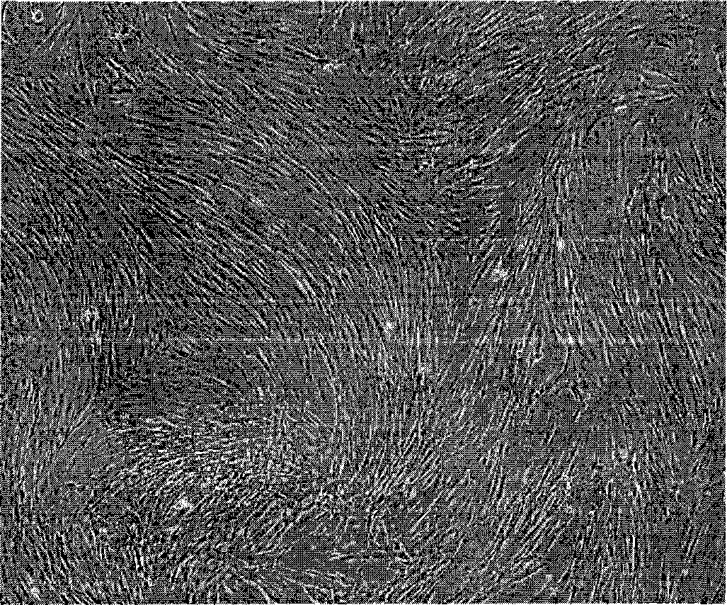 Method for using umbilical stalk placenta to prepare mesenchyma stem cell