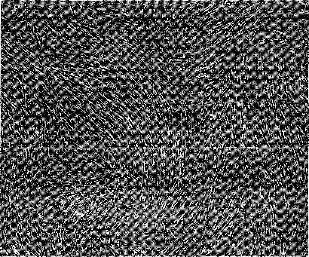 Method for using umbilical stalk placenta to prepare mesenchyma stem cell