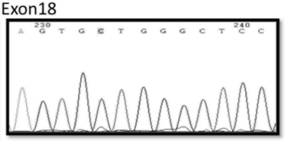 Method and chip for detecting tumor cell EGFR (epidermal growth factor receptor) gene mutation