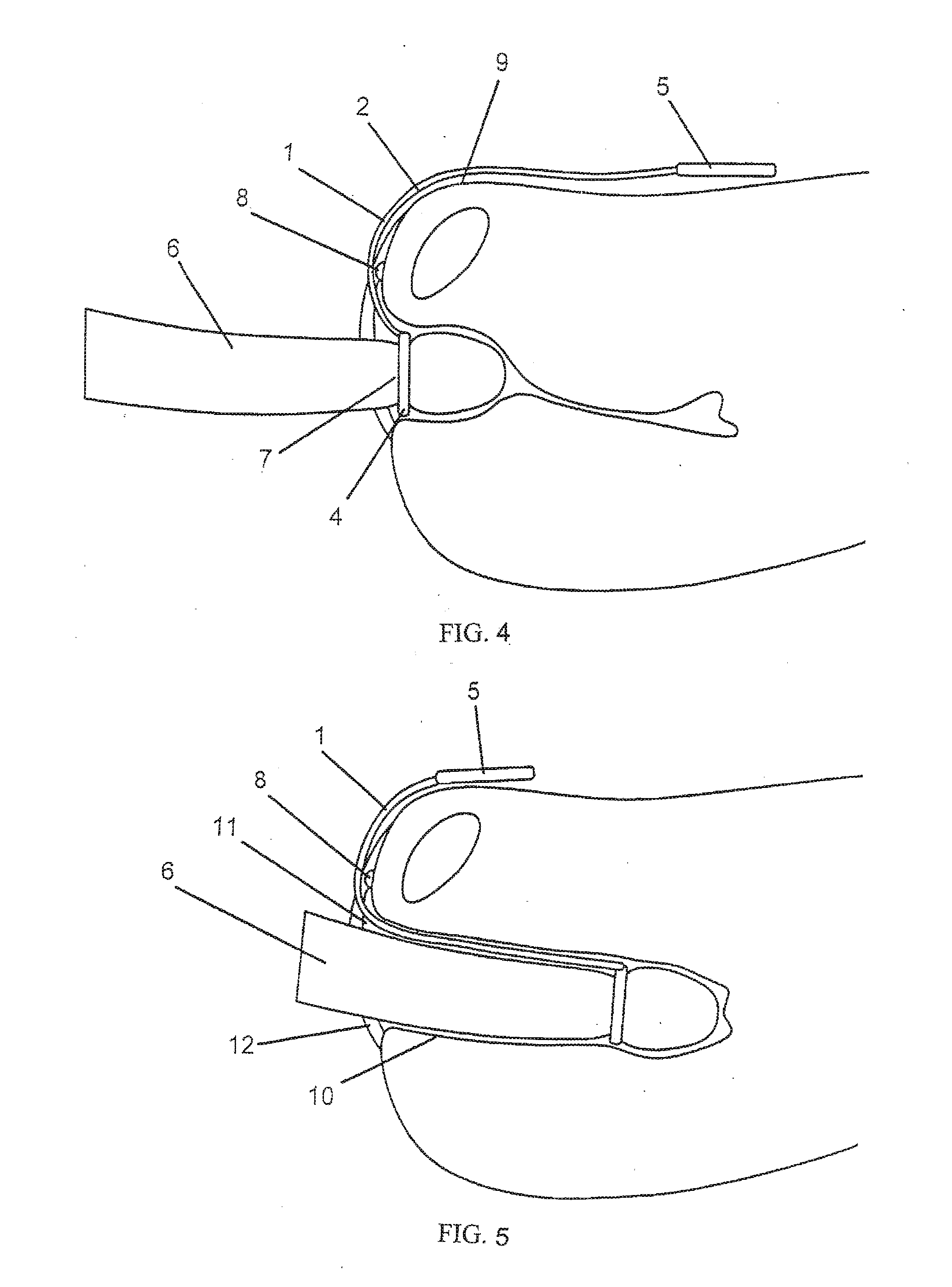 Clitoris Friction Stimulator and Method For Stimulating Erogenic Zones Of A Woman During A Coition
