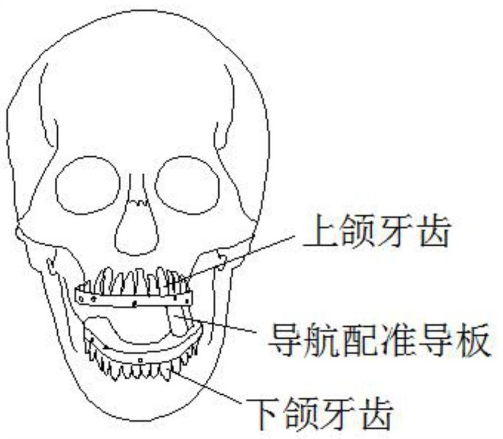 Fixed jaw position navigation registration guide and its registration method