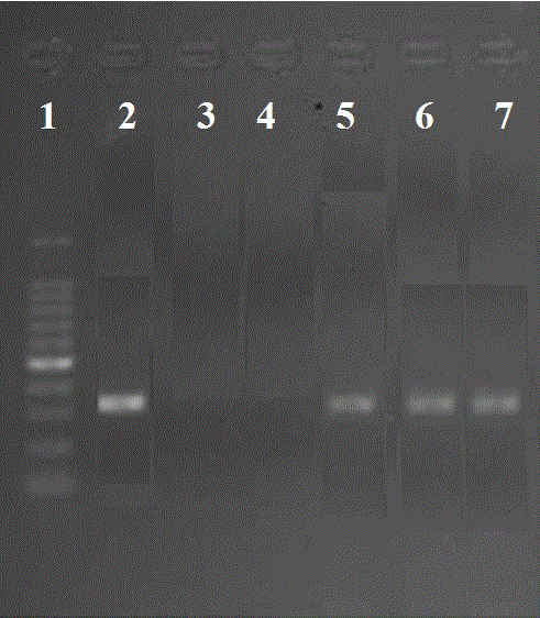Kit for detecting male infertility Fkbp6 gene mutation site, and PCR amplification method thereof