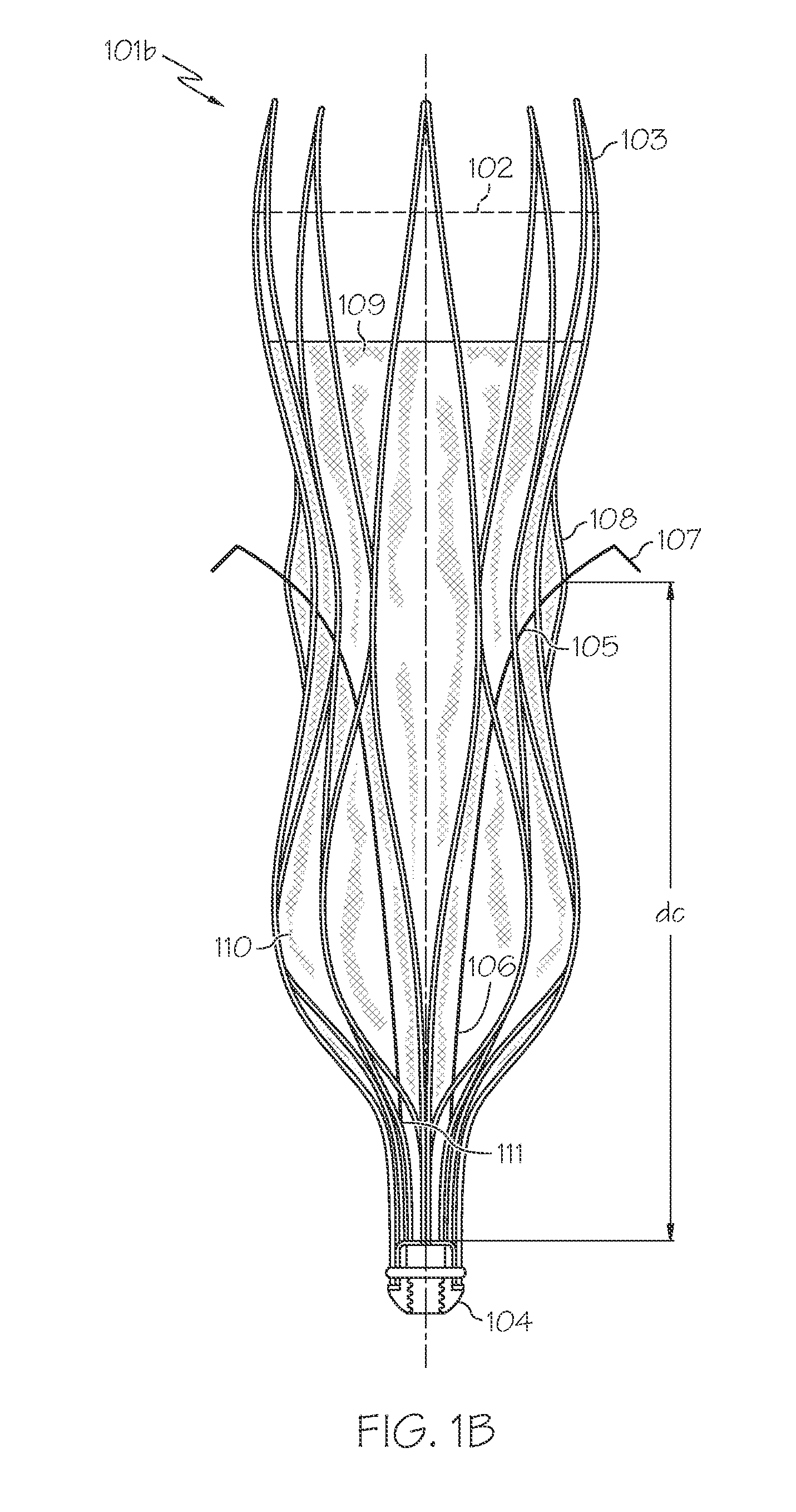 Fixation Anchor Design for an Occlusion Device