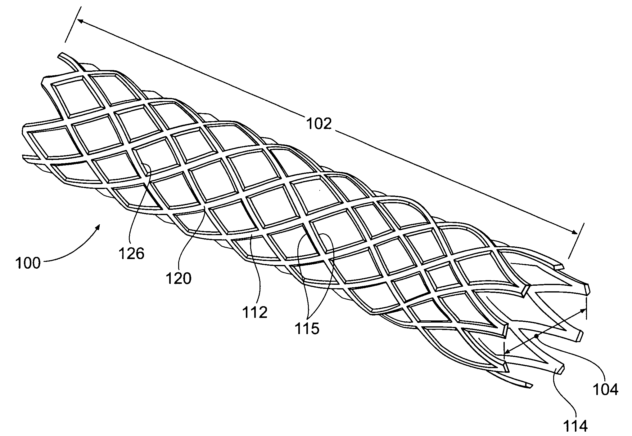Apparatus and method for minimizing flow disturbances in a stented region of a lumen
