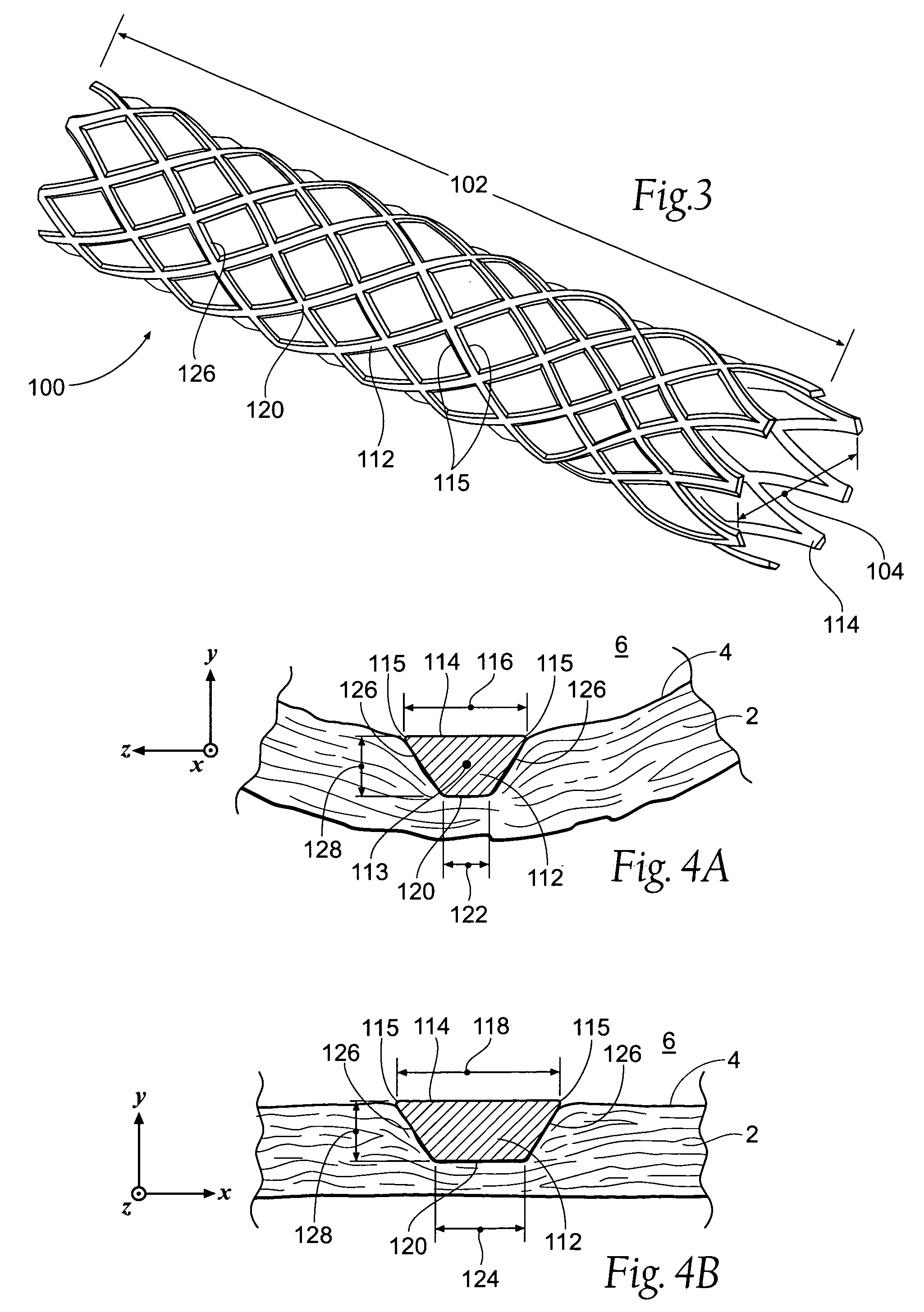 Apparatus and method for minimizing flow disturbances in a stented region of a lumen