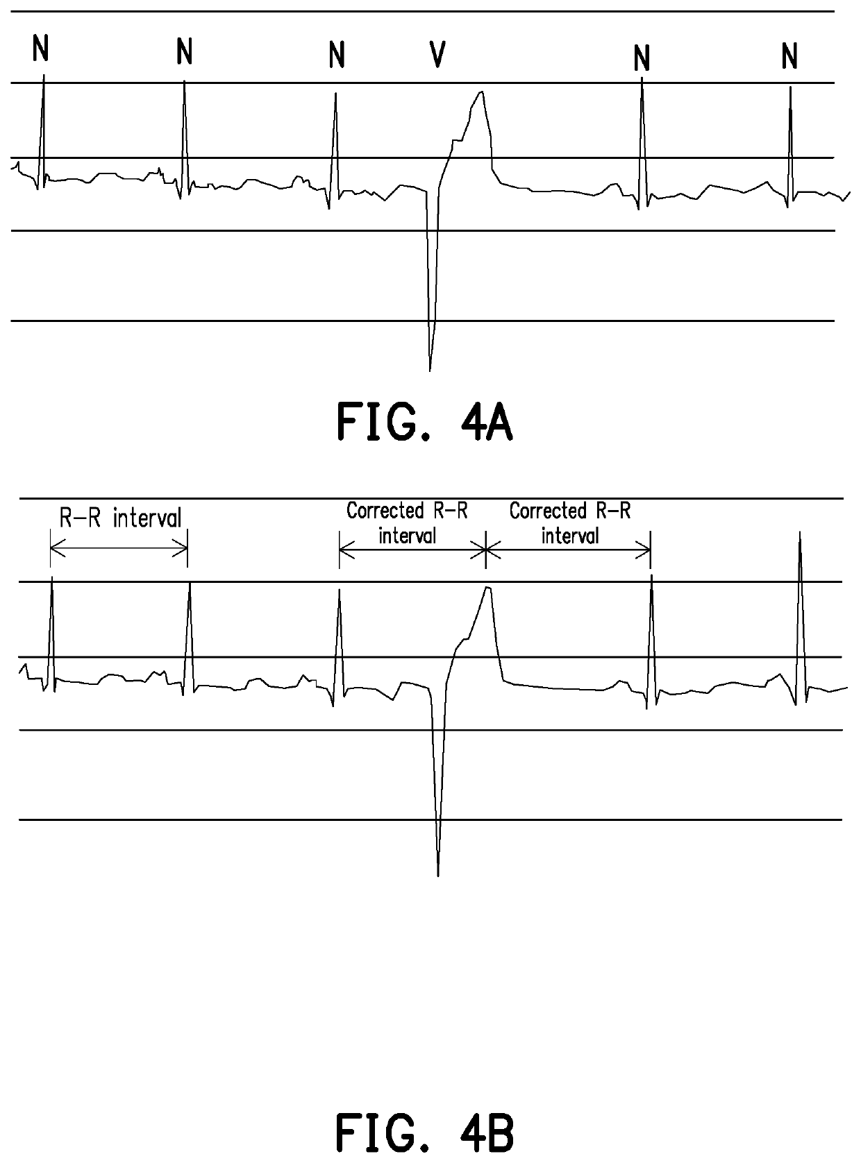 Computation apparatus, cardiac arrhythmia assessment method thereof and non-transitory computer-readable recording medium