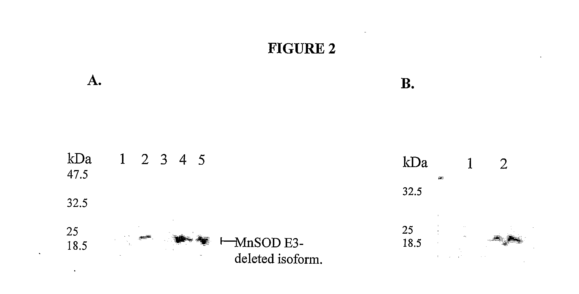 Compositions and Methods For Inhibiting an Isoform of Human Manganese Superoxide Dismutase
