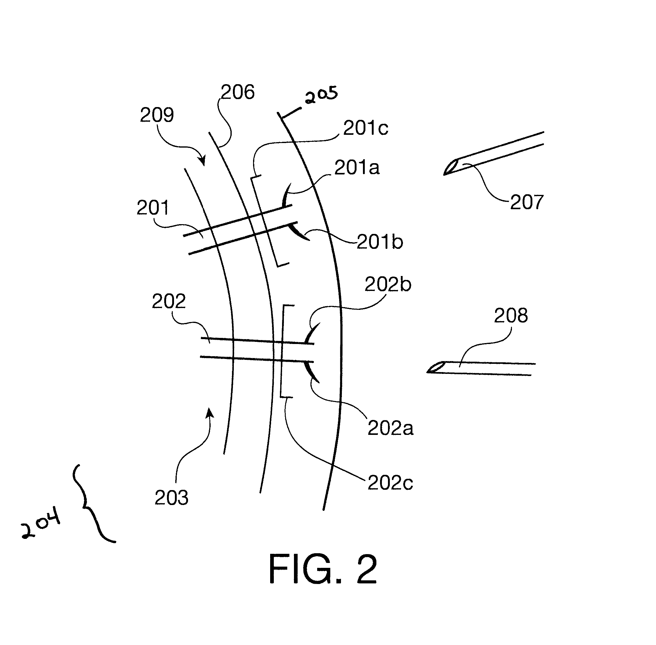 System and Method for Administering Peritoneal Dialysis