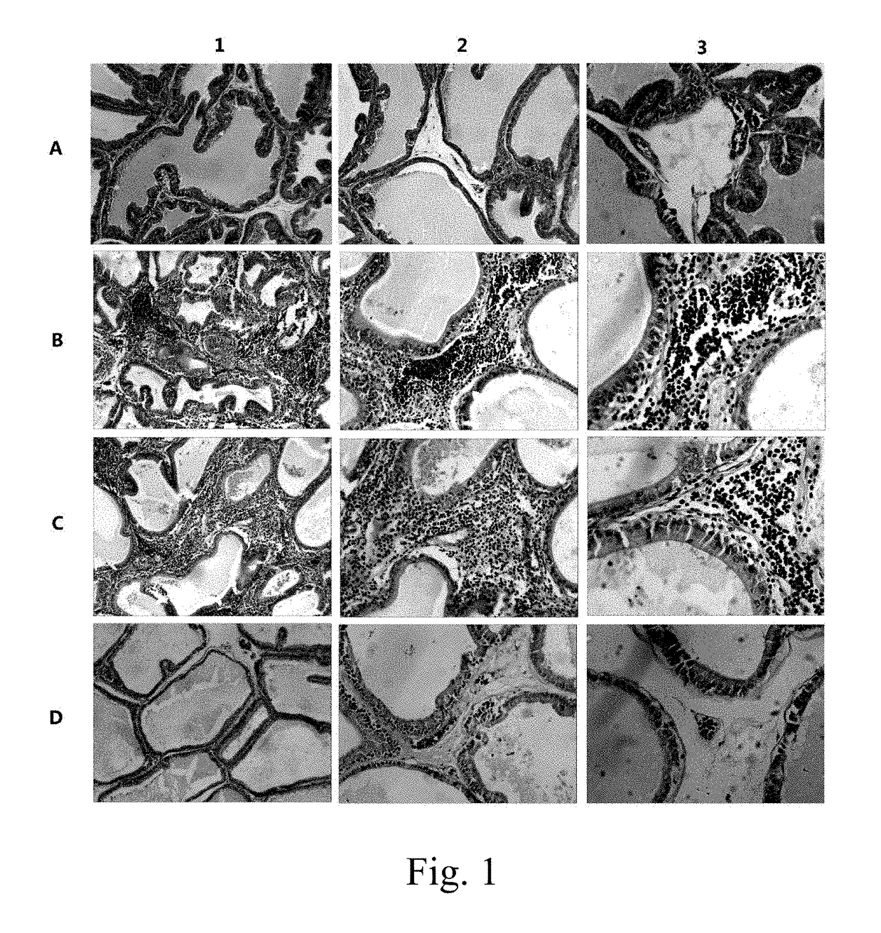 Application of TRPM8 protein, related peptide fragment and their antibodies