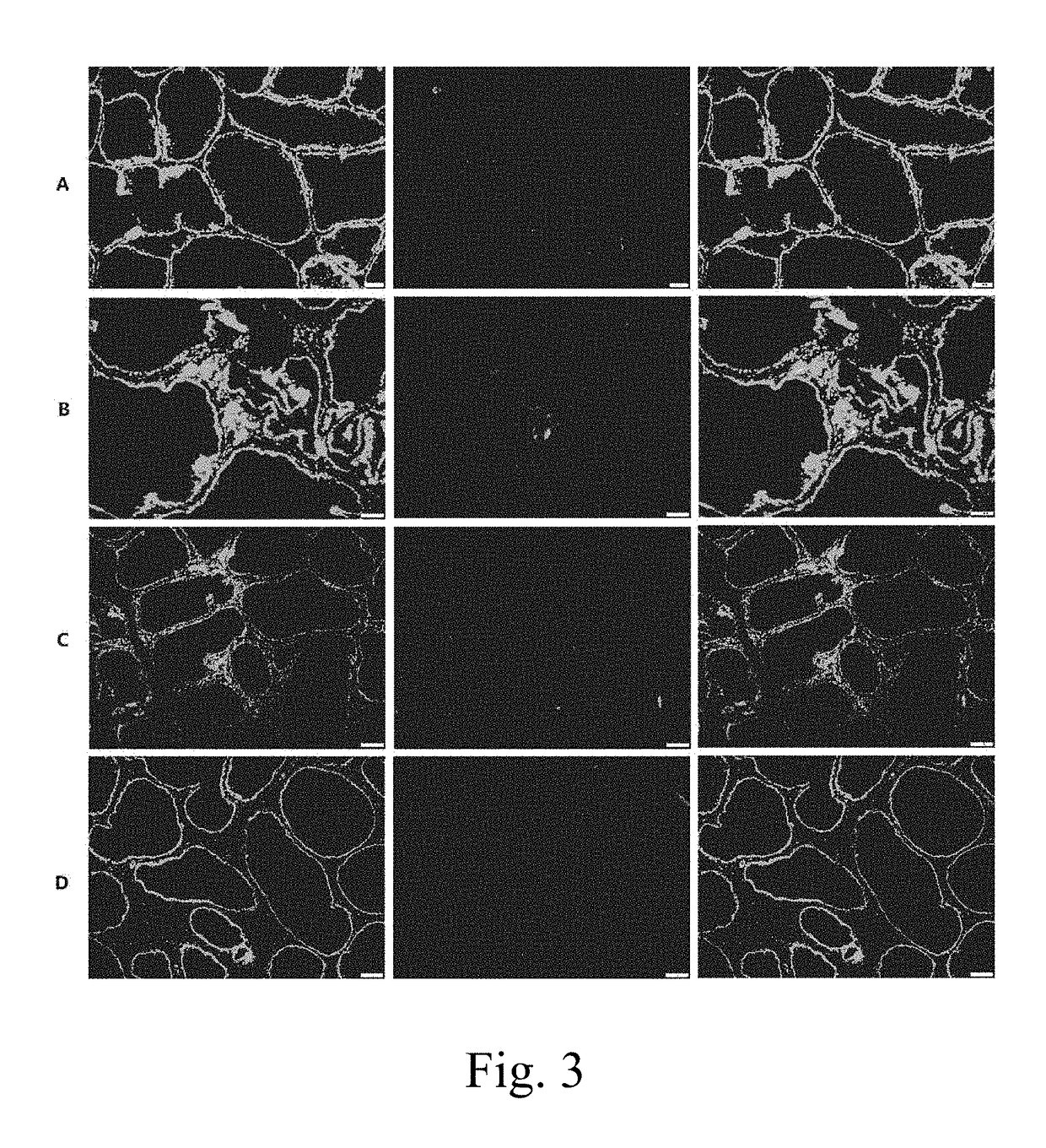 Application of TRPM8 protein, related peptide fragment and their antibodies