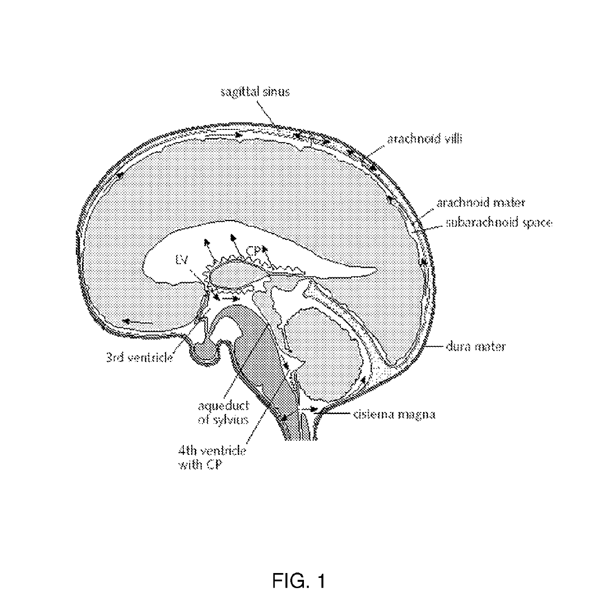 Use of TRPV4 antagonists to ameliorate hydrocephalus and related materials and methods