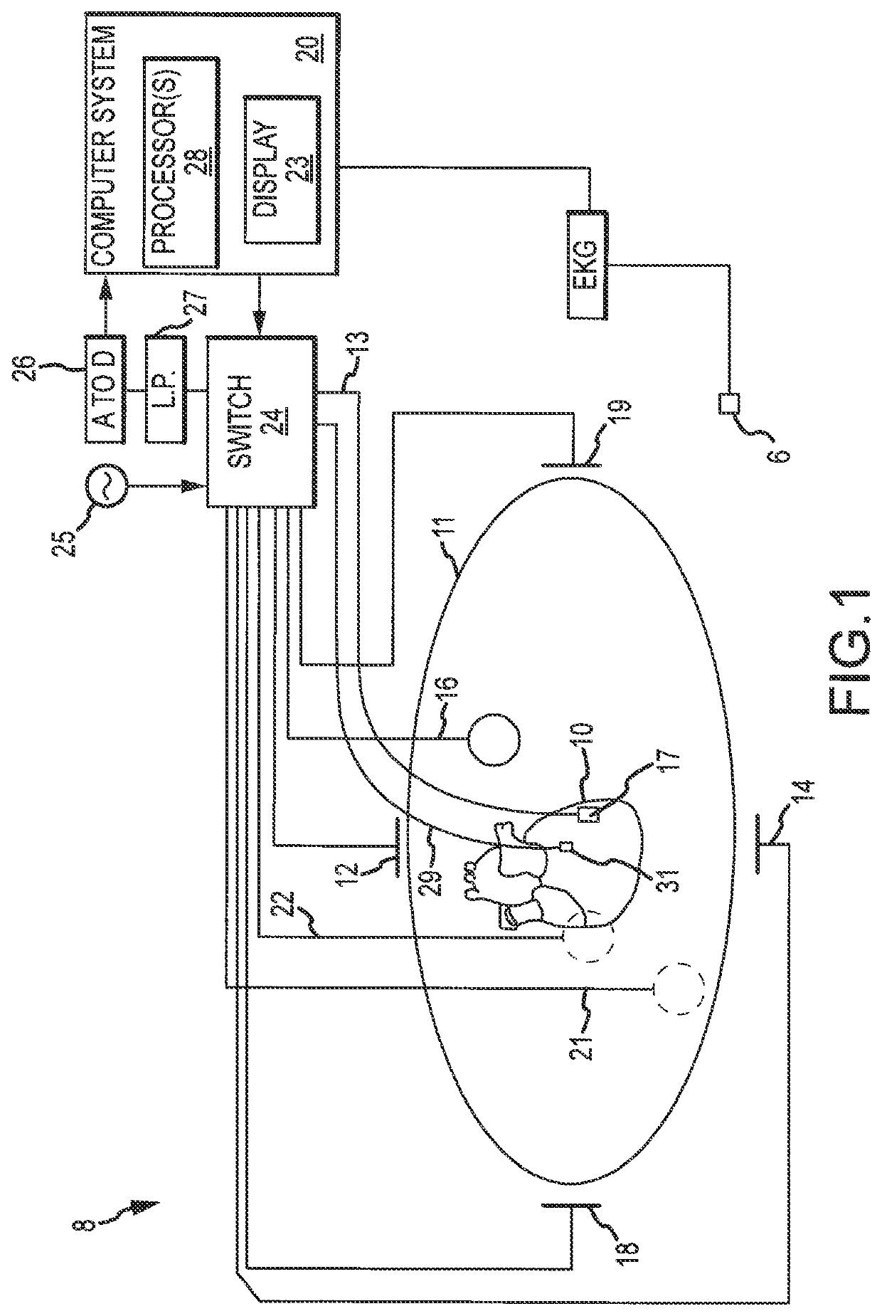 Methods and systems for mapping cardiac repolarization