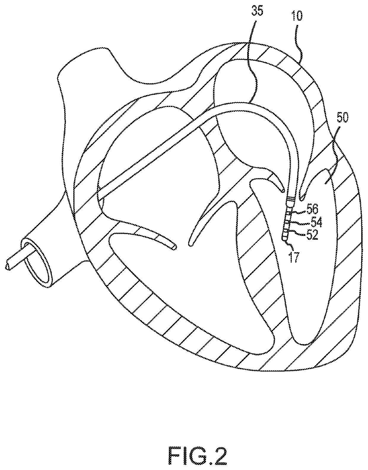 Methods and systems for mapping cardiac repolarization