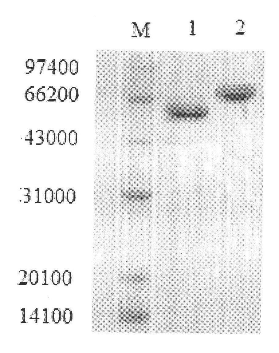 Kit and method for clinically detecting serum or plasma free fatty acid