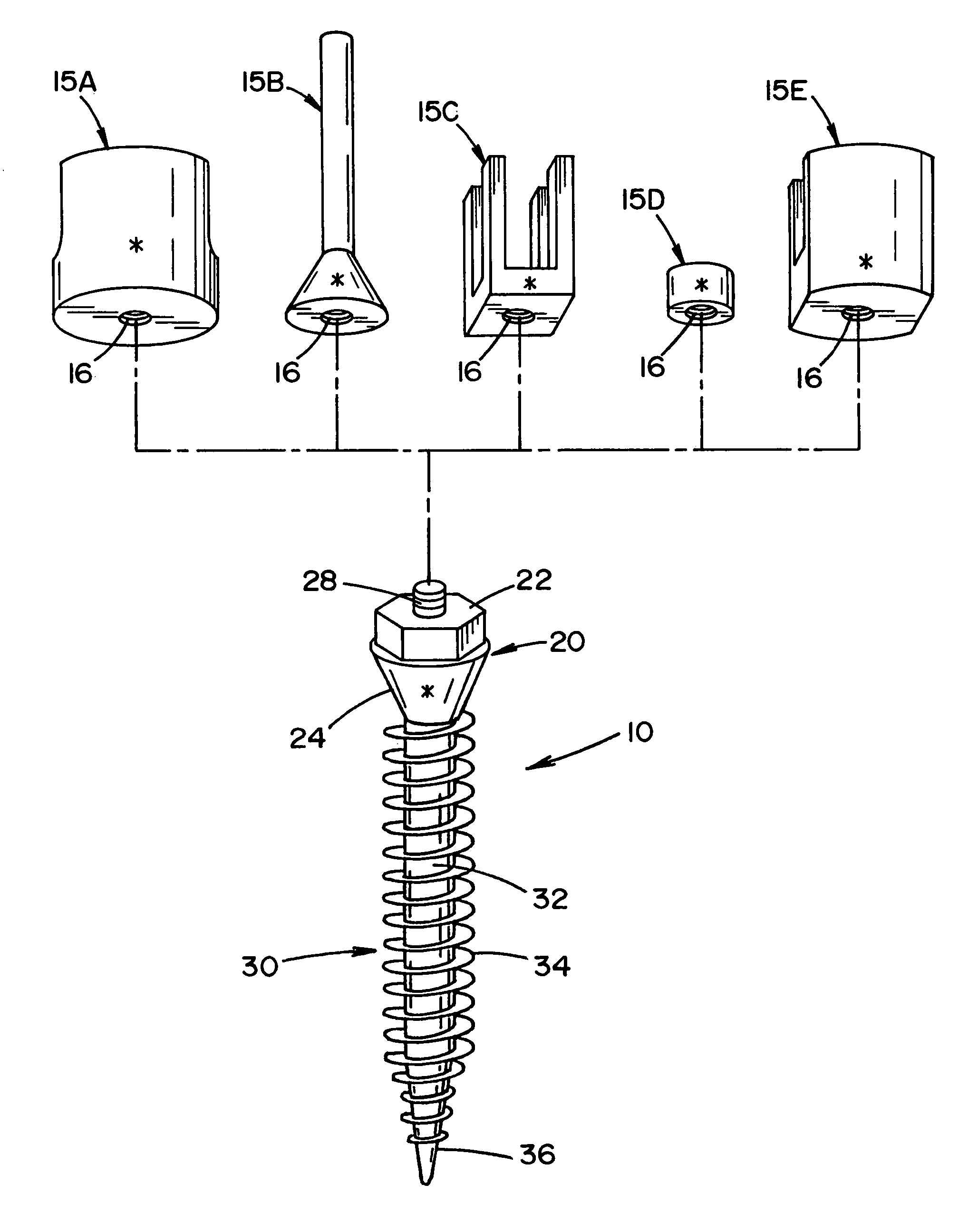Bone anchor prosthesis and system