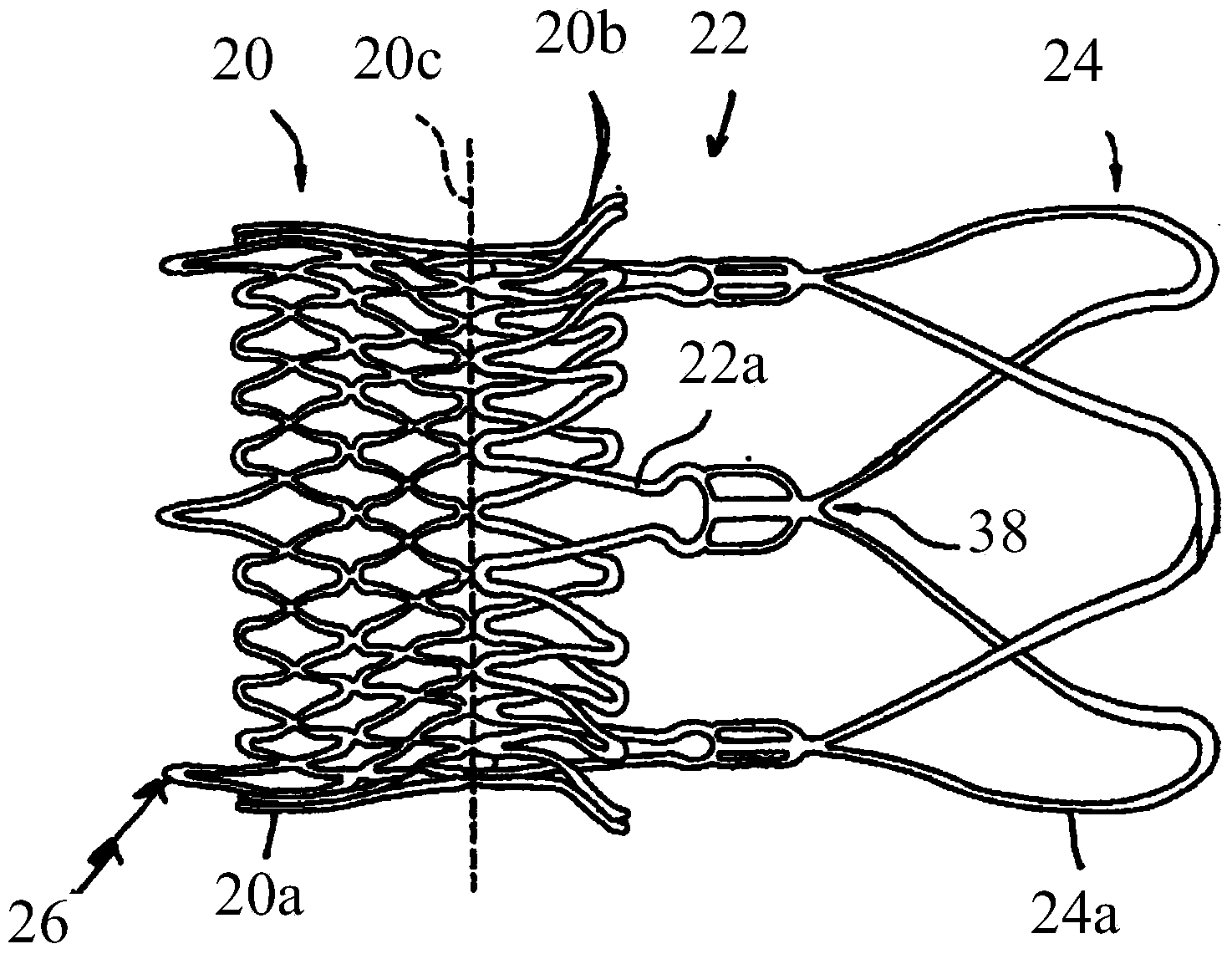 Method and apparatus for compressing/loading stent-valves