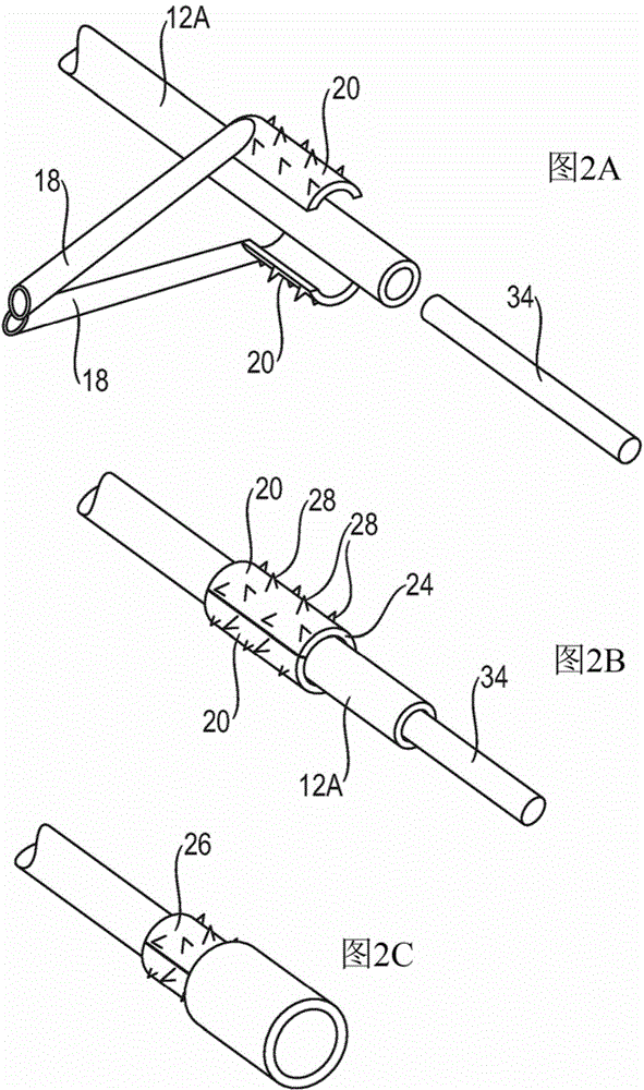 Electrosurgical instrument for producing an end-to-end anastomosis