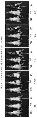 Method for diagnosing breast cancer via microbial metagenomic analysis