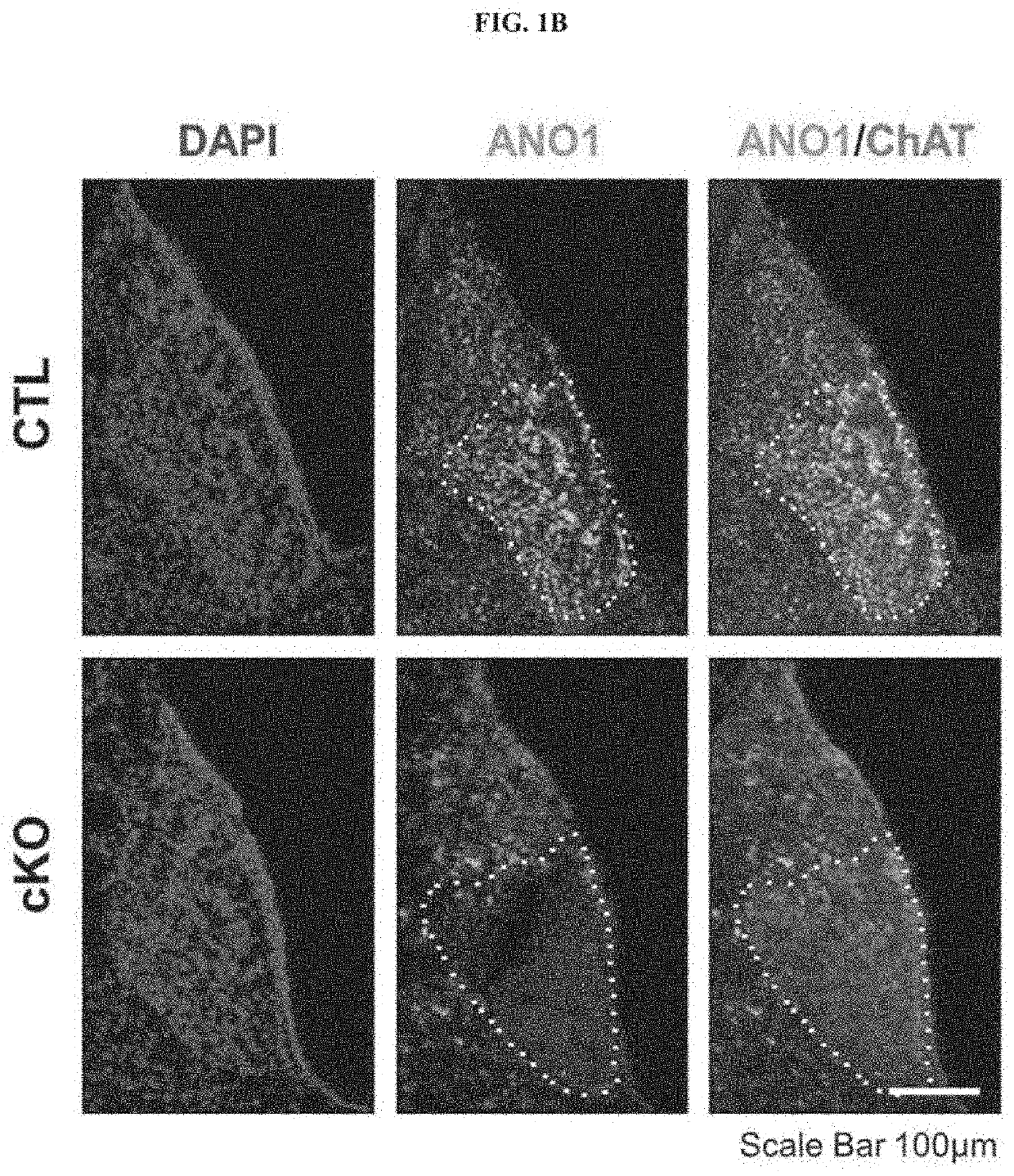 Schizophrenia animal model and preparation method therefor