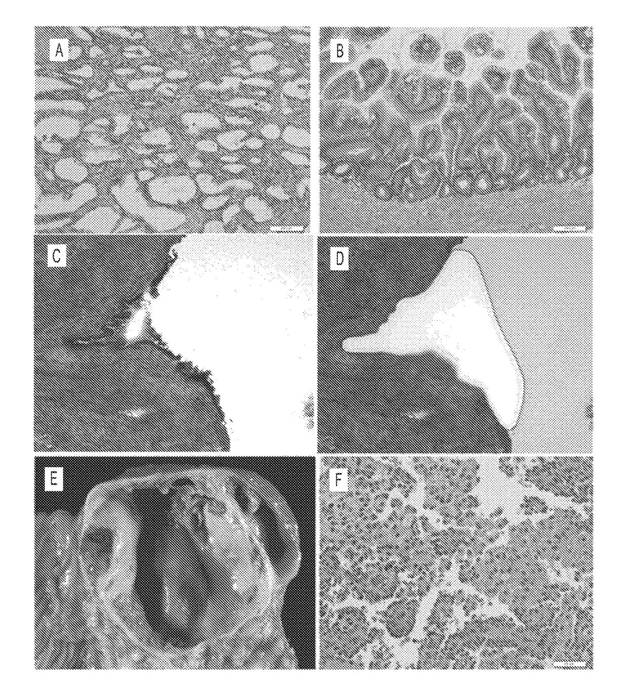 Differential identification of pancreatic cysts