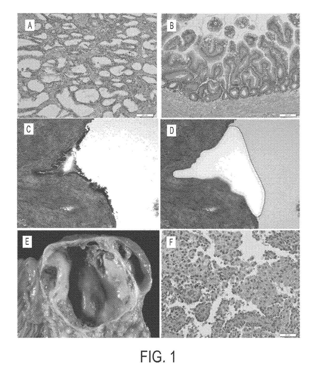 Differential identification of pancreatic cysts