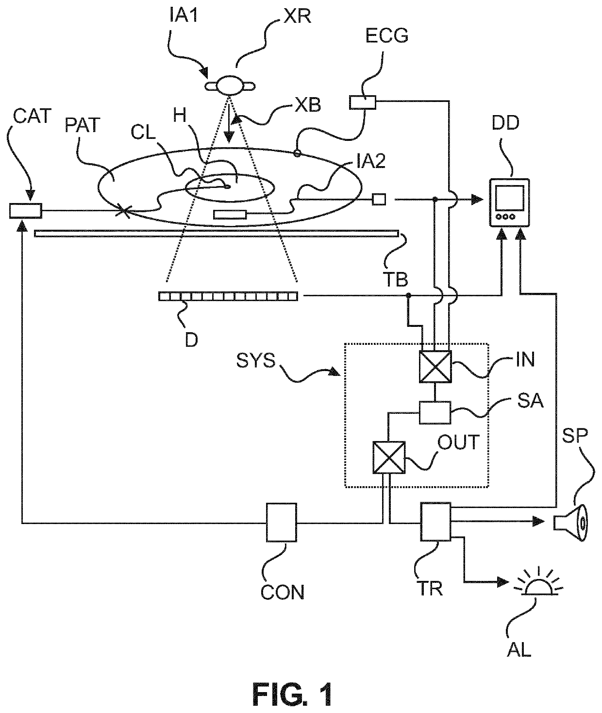 Signal-triggered interventional device control