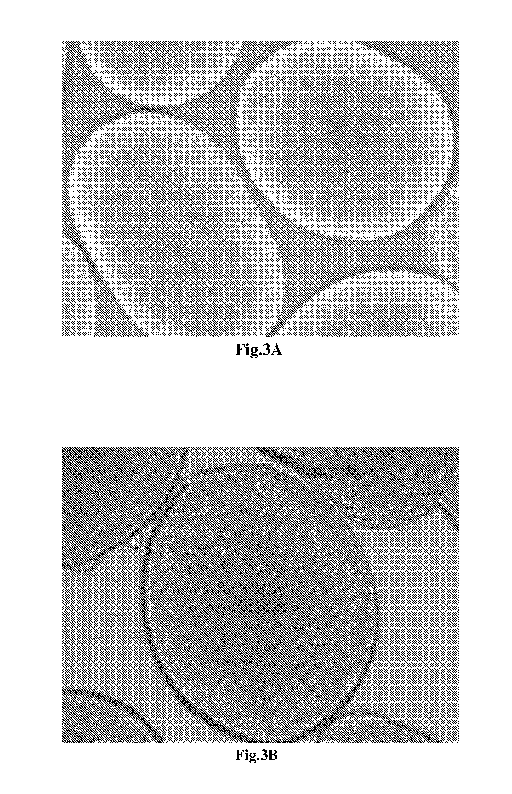 Method for neuroepithelial cells differentiation from pluripotent stem cells and medium using same
