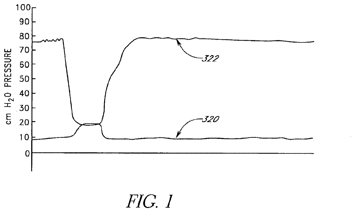 Method of removing an inflated implant from a bladder