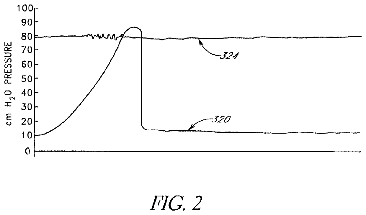 Method of removing an inflated implant from a bladder