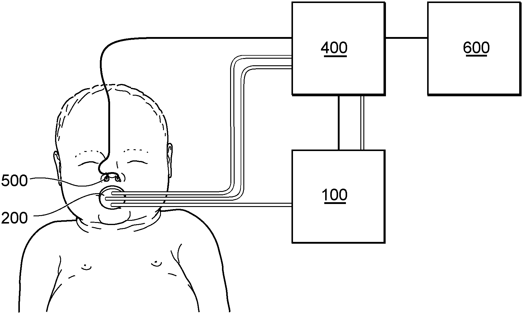 Apparatus and method for the collection of samples of exhaled air