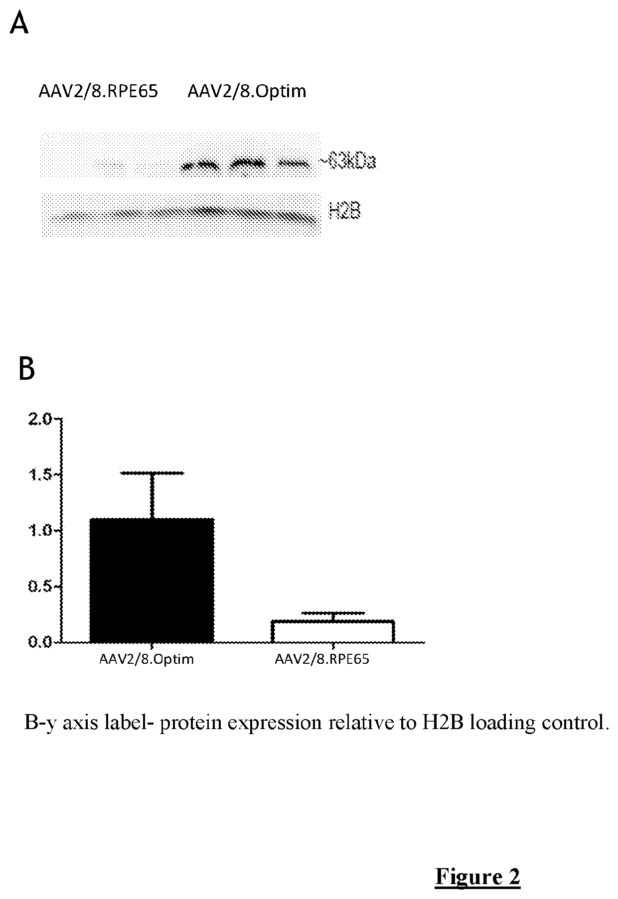 Optimized RPE65 promoter and coding sequences