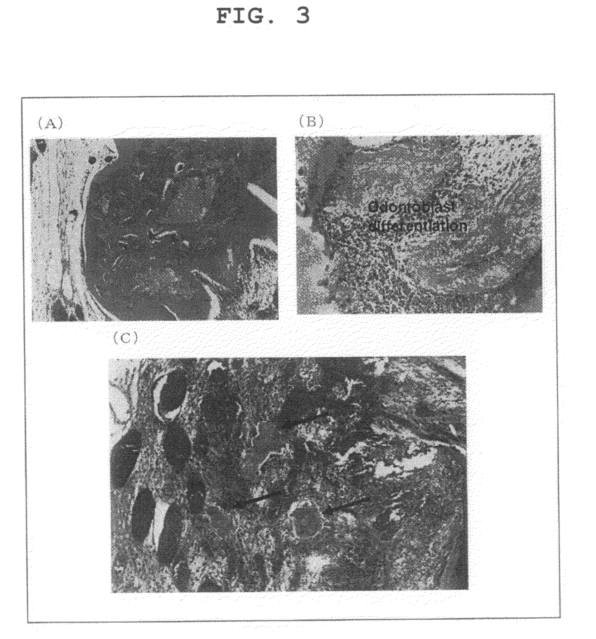 Therapeutic Agent for Dentin-Pulp Complex Regeneration