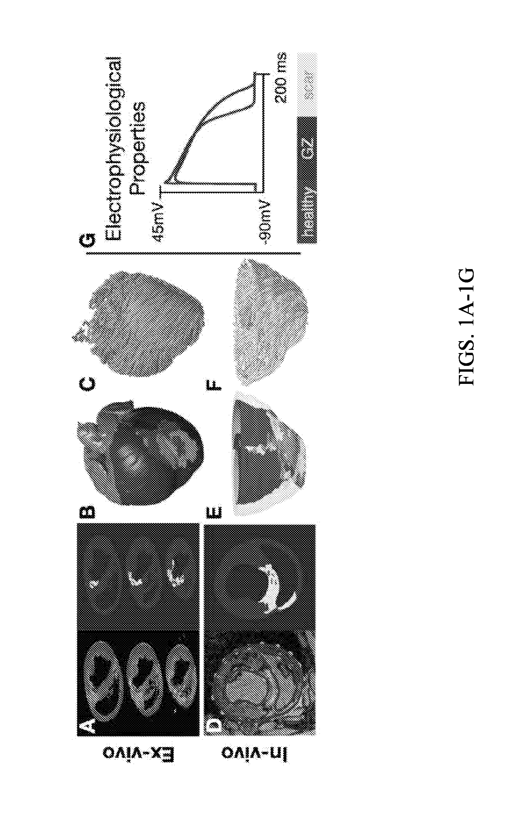 System and method for planning a patient-specific cardiac procedure