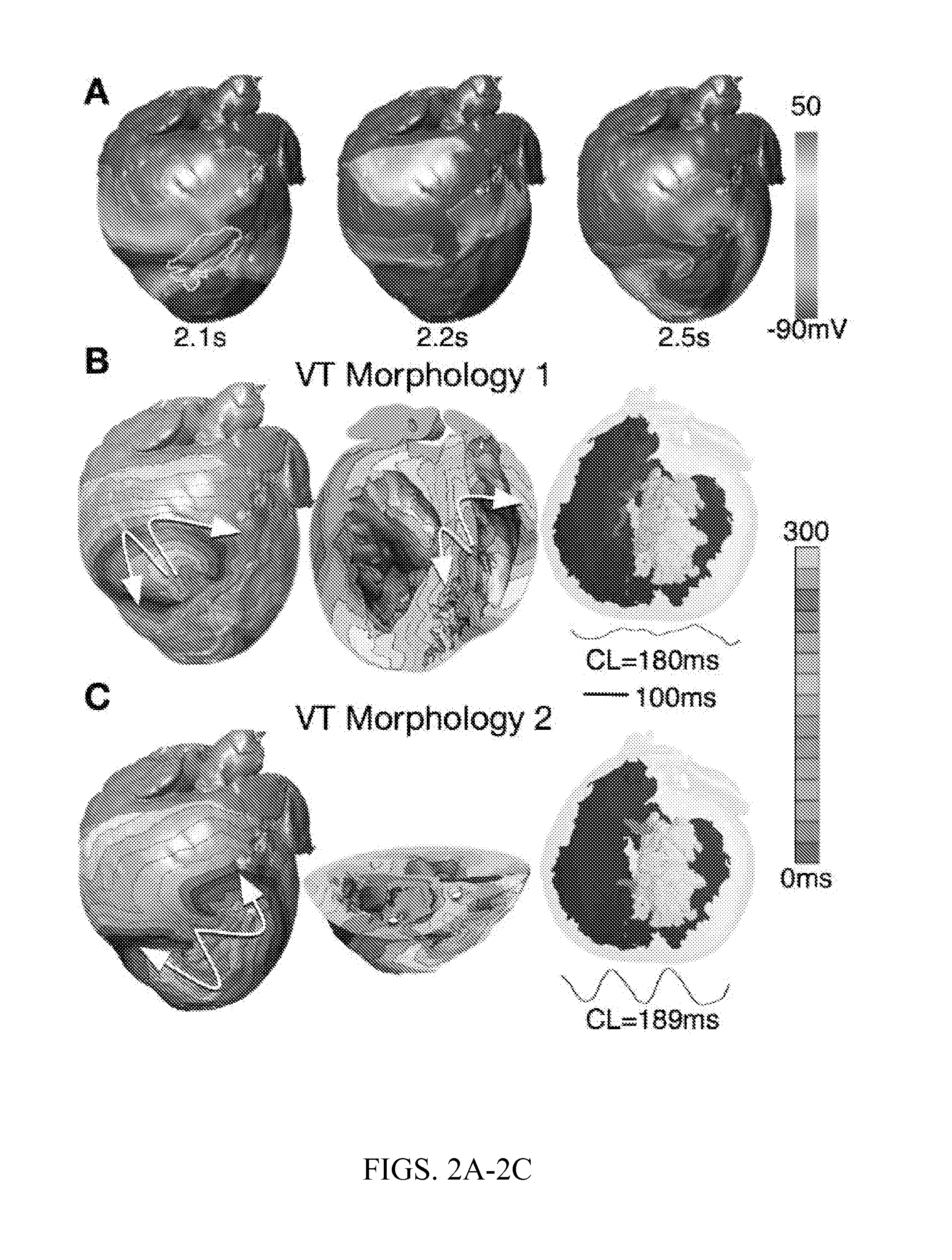 System and method for planning a patient-specific cardiac procedure