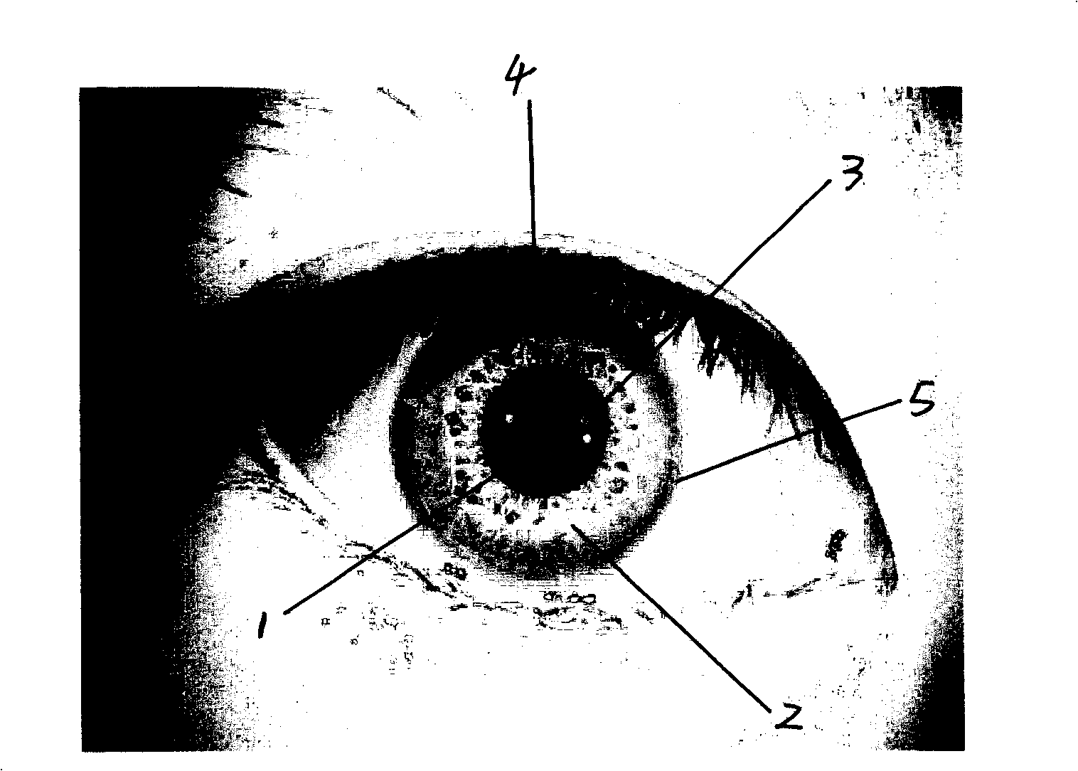 Iris positioning method based on multi-resolutions analysis