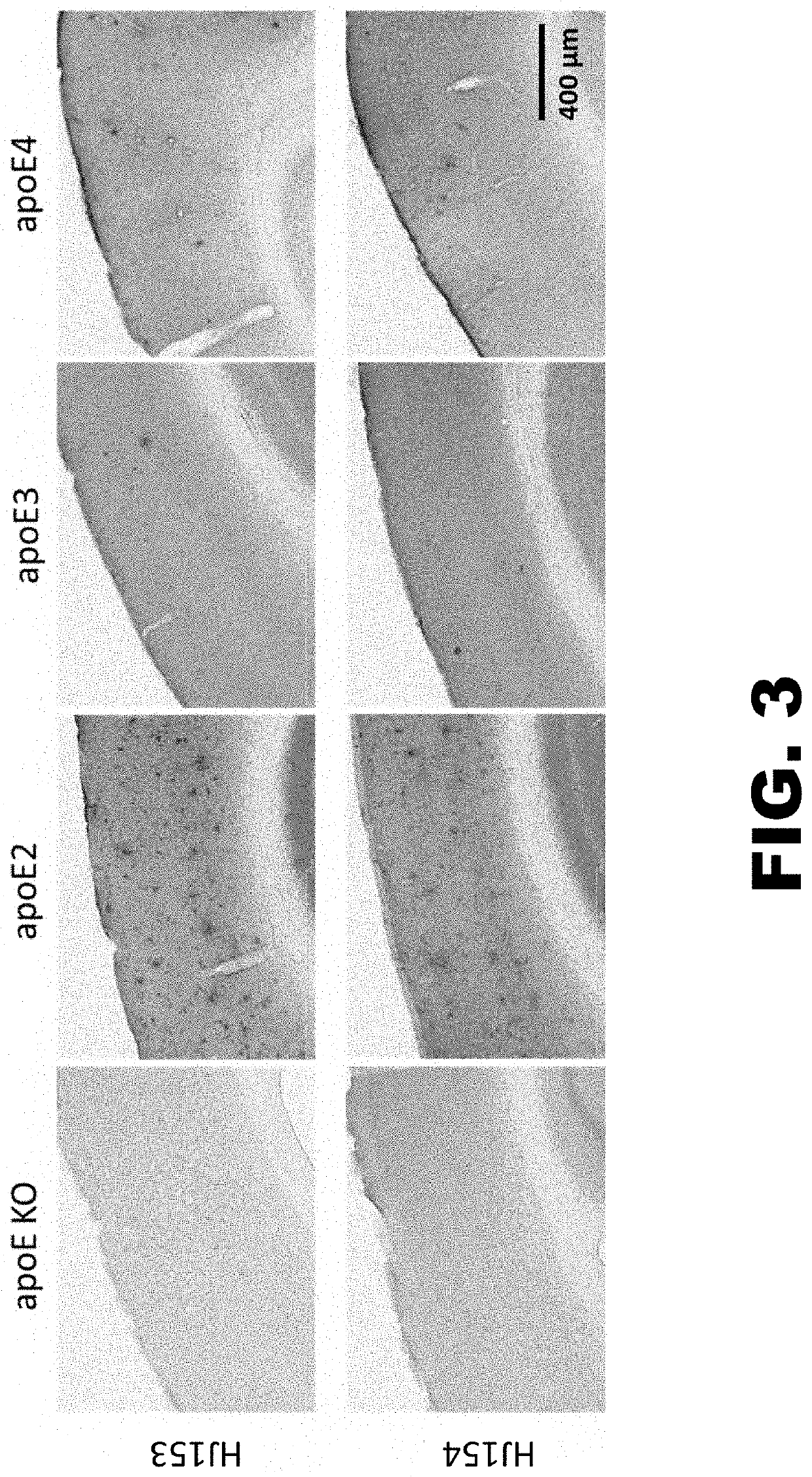 Anti-ApoE antibodies