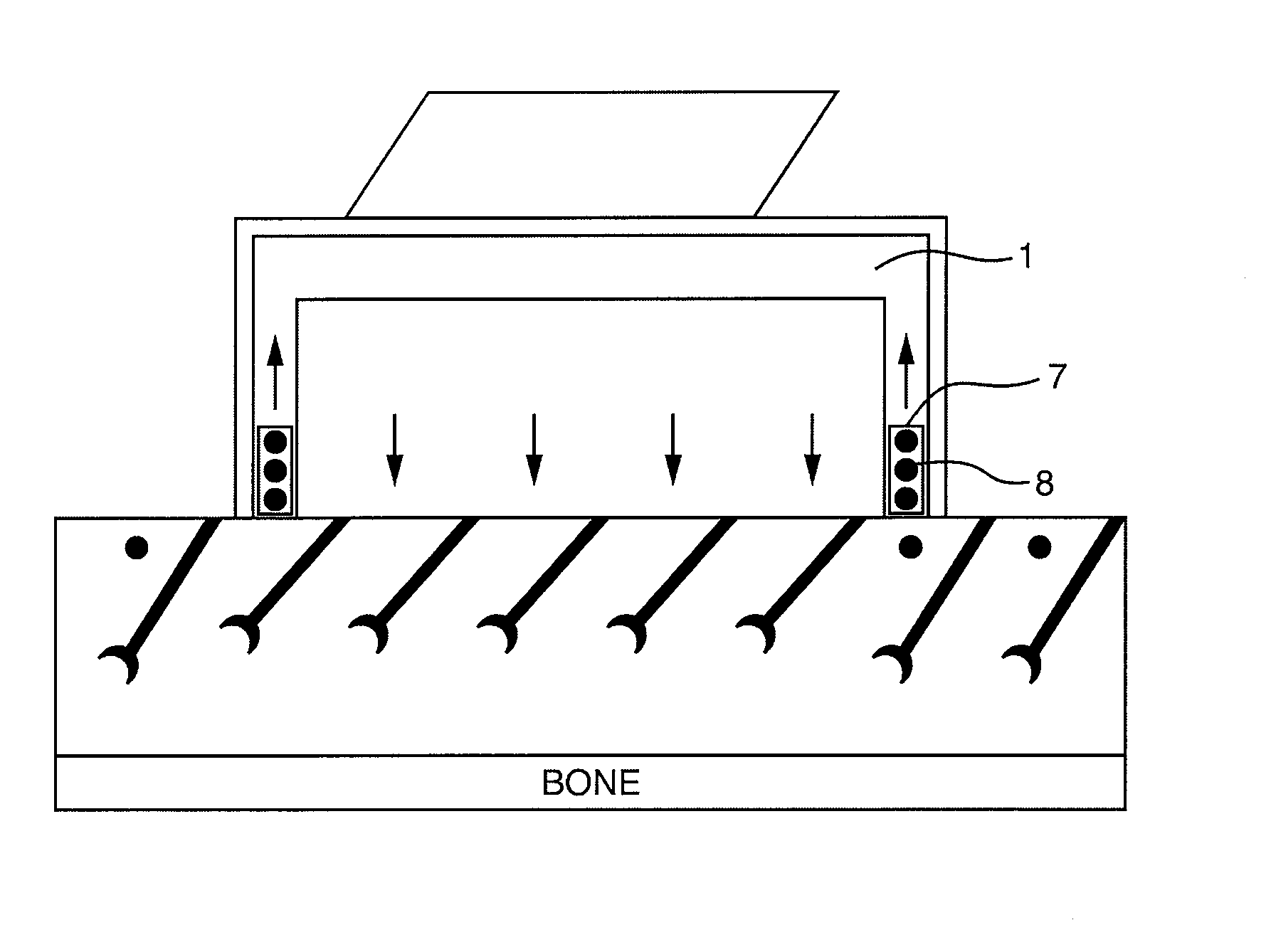 Apparatus and method for skin treatment with compression and decompression
