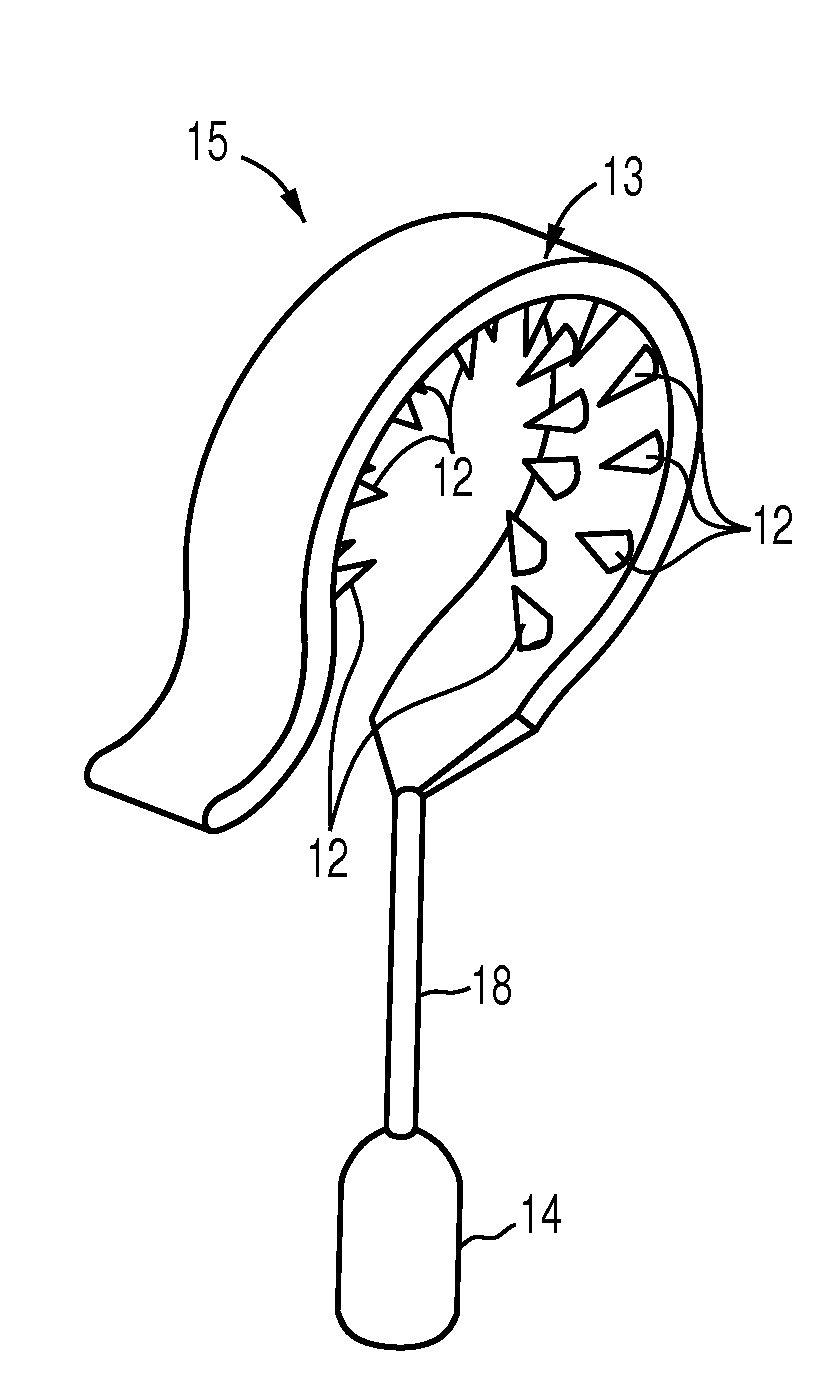 Middle ear prosthesis having discrete projections for purposes of ossicular attachment
