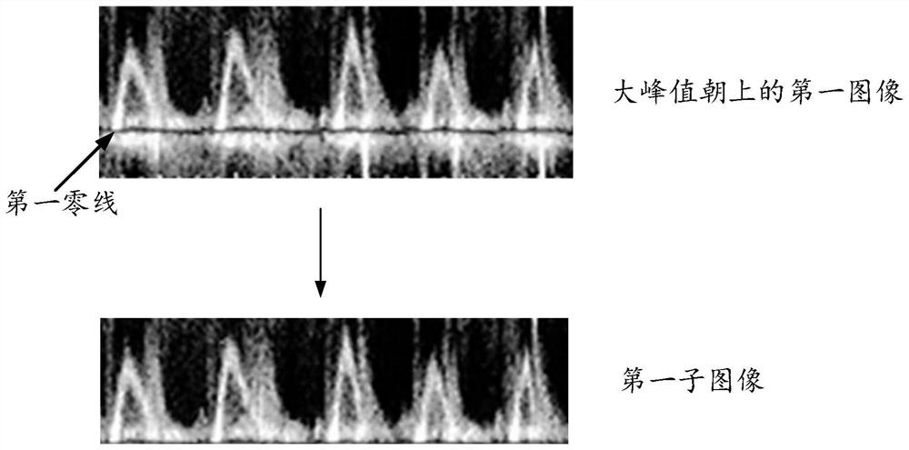 Method and device for processing two-dimensional spectrum Doppler echocardiography image