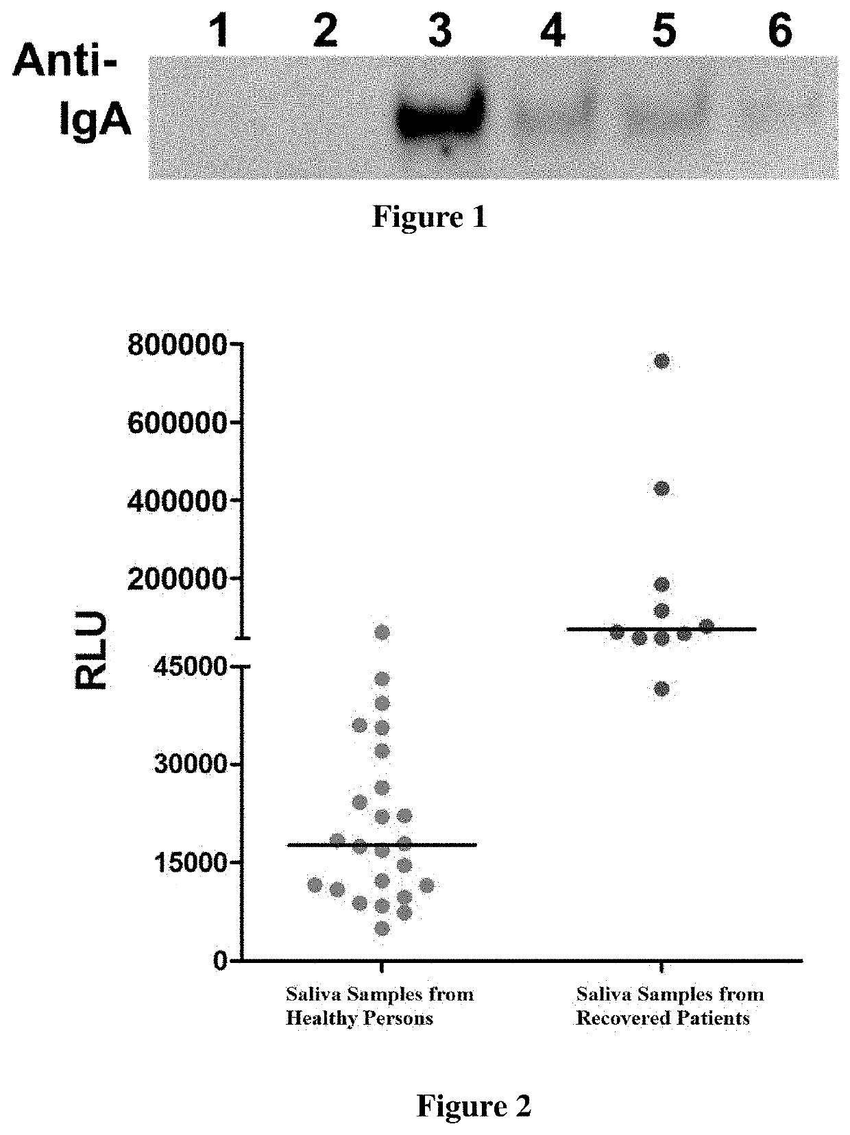 Method for diagnosing sars-cov-2 infection