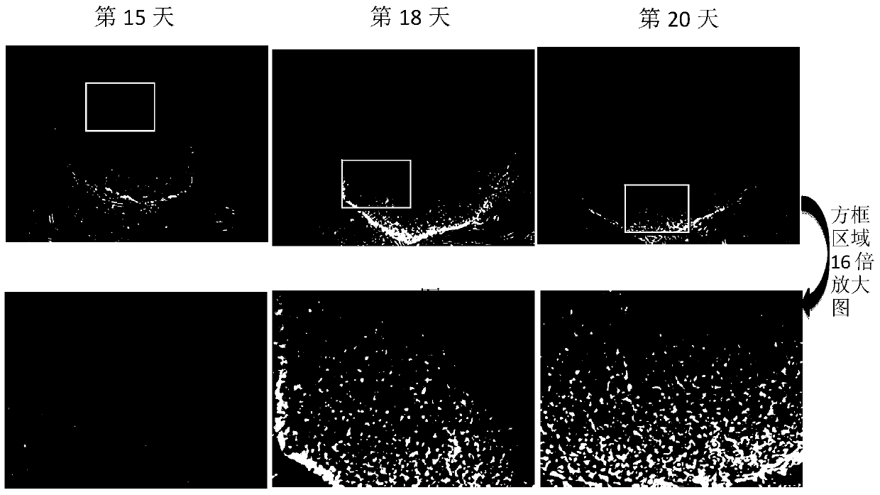 Arvc disease-specific human induced pluripotent stem cell strain and use thereof