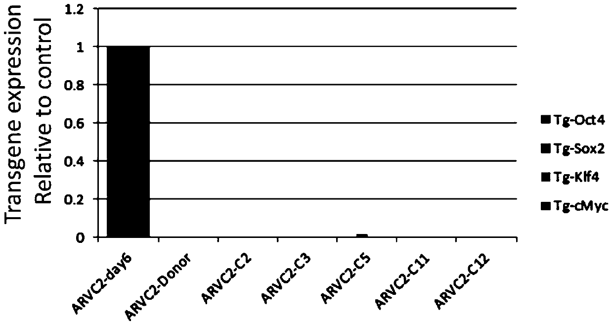 Arvc disease-specific human induced pluripotent stem cell strain and use thereof