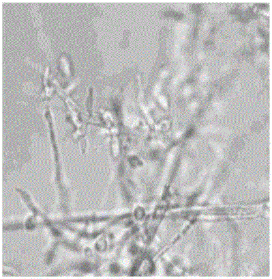 Intestinal cellulose-degrading fungi of dragonfly larvae and their applications