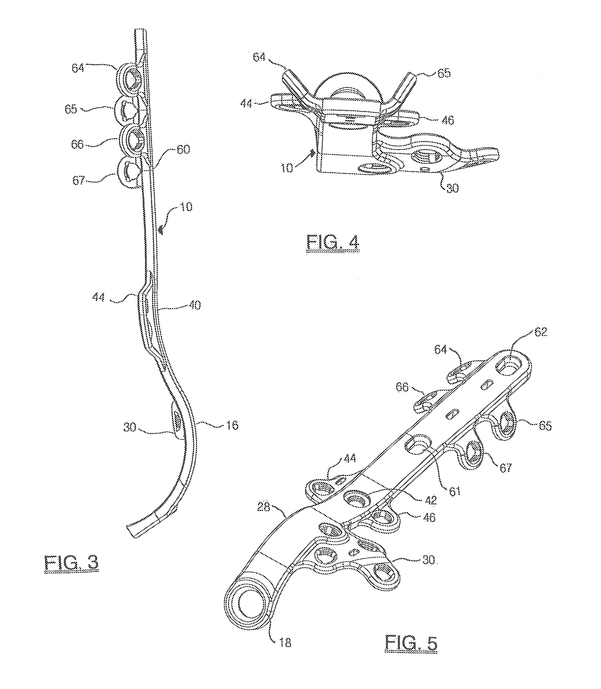 Lateral ankle fusion plate system and jig, and method for use therewith
