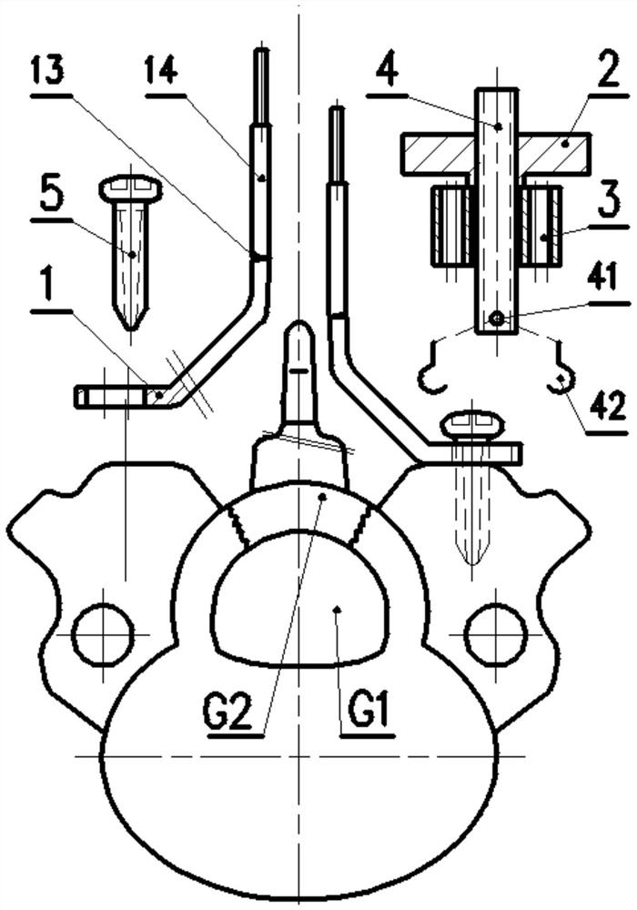 Special tool and screw plate system for double open door cervical spinal canal expansive laminoplasty