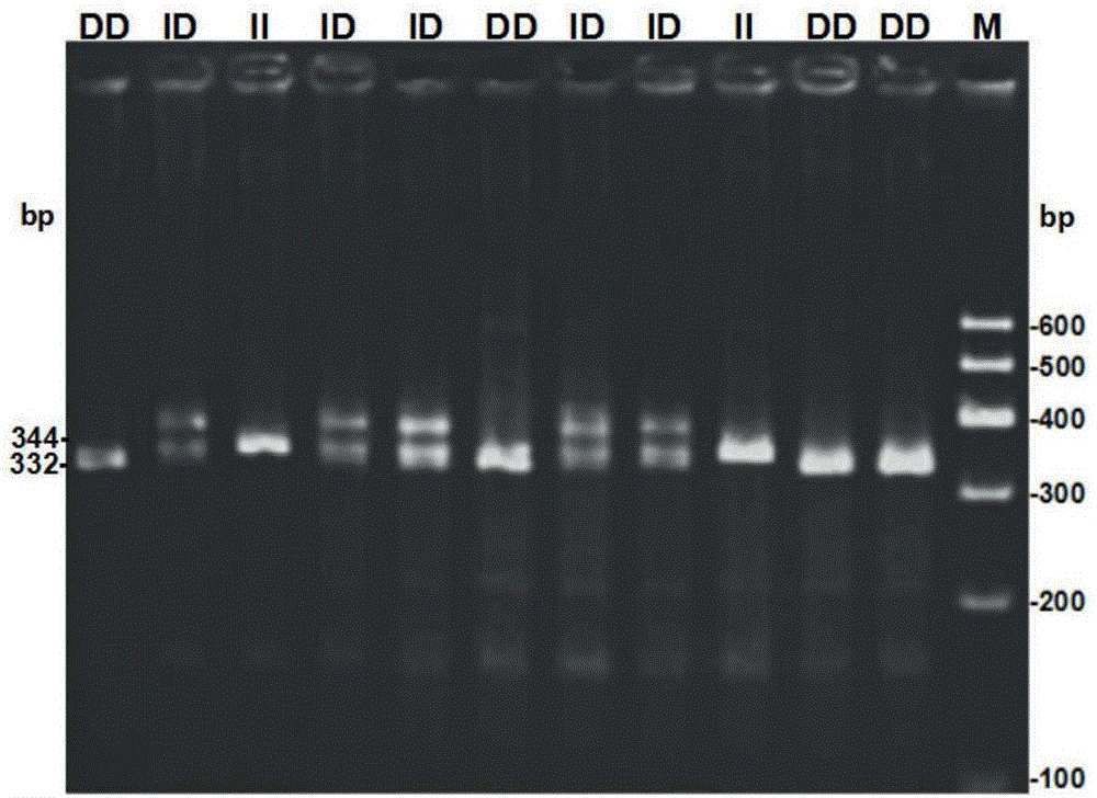Pig Oct4 gene insertion/lack detection method and application thereof